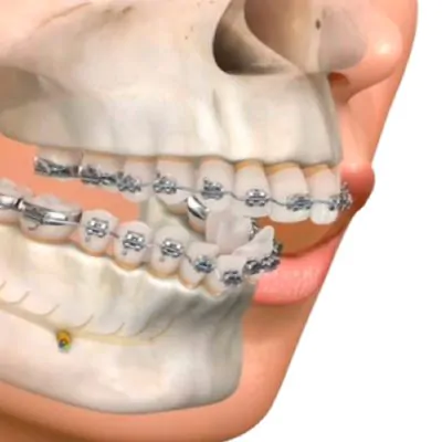 bucomaxilofacial