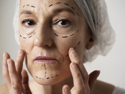 Botox BH