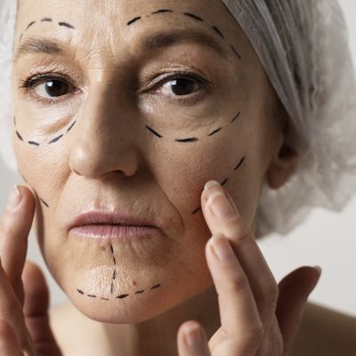 Botox BH