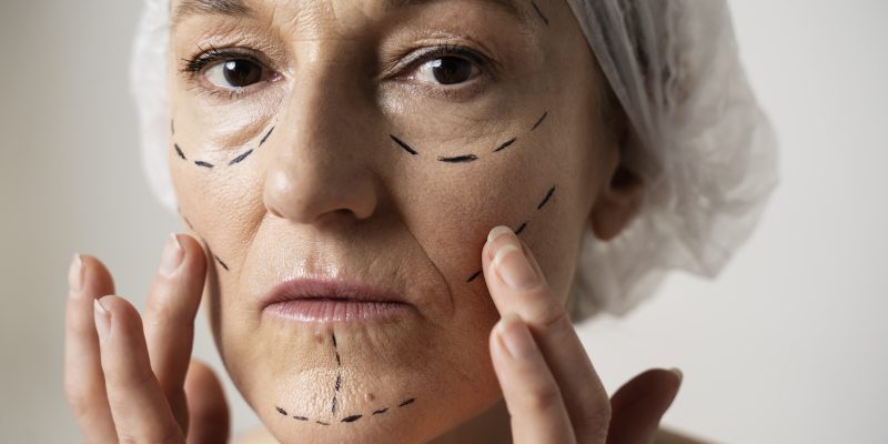 Botox BH
